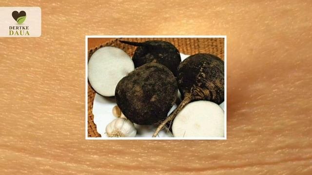 Xирург дәрігер өз көзіне, өзі сенбеді, Мен мына әдіспен Липома (жировик)-тан құтылдым.