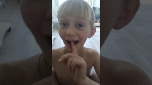 1 молочный зуб шатается.