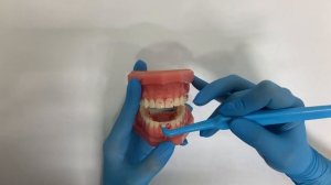 Использование монопучковой зубной щетки