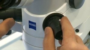 Удаление катаракты лазером в клинике "Эксимер" | Фемтосекундное сопровождение факоэмульсификации