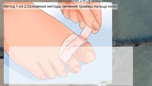 Как лечить ушиб пальцев ног