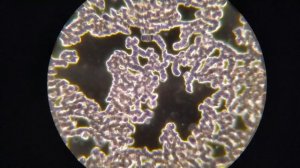 Как избавиться от бактерий в крови. В поисках метода