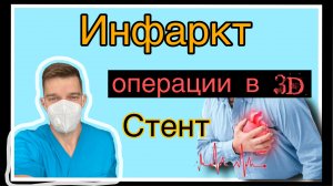 Врач - просто о сложном / инфаркт миокарда / стентирование / рентгенхирургия