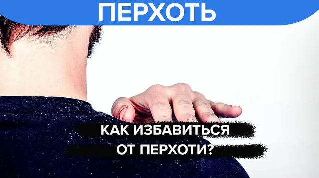 Как избавиться от перхоти? - Доктор 24