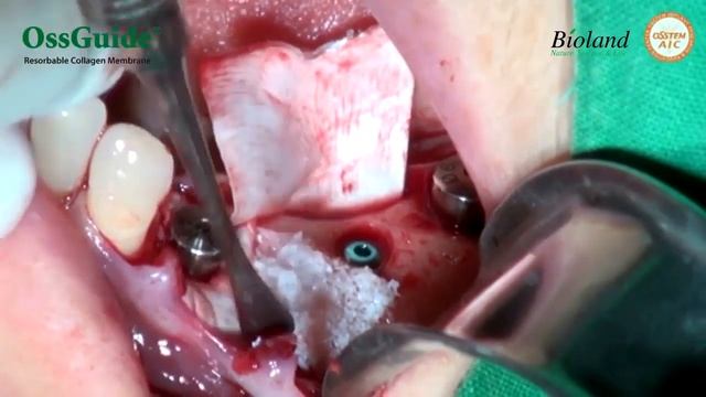 OssGuide мембрана смотреть онлайн