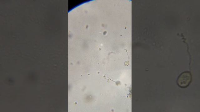 Вода из лужи, выращивание микроорганизмов. смотреть онлайн