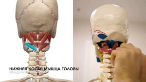 Глубокие мышцы шеи и спины. Как выглядят подзатылочные мышцы шеи и спины? Анатомия 3D