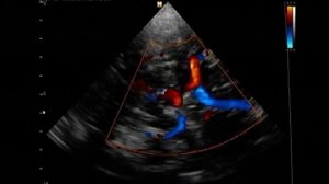 Технология исследования интракраниальных брахиоцефальных сосудов