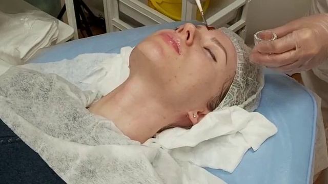 АирисКом студенты учатся: семинар по пилингам (салициловый и ТСА пилинг в одной процедуре)