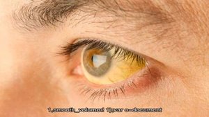 Как лечить повышенный билирубин