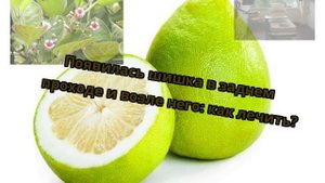 Появилась шишка в заднем проходе и возле него: как лечить?