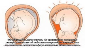 Чем отличаются потуги от схваток?