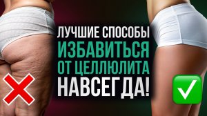 Как навсегда избавиться от целлюлита? / Убираем целлюлит в ДОМАШНИХ УСЛОВИЯХ