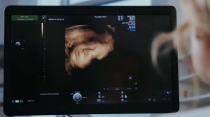 ПИТАНИЕ ВО ВРЕМЯ БЕРЕМЕННОСТИ | Правильное питание во 2 триместре беременности