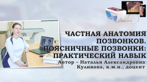 13. Частная анатомия позвонков. Поясничные позвонки. Практический навык