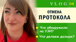 ЭКО. Начался цикл // Не вступила в протокол // Неожиданность на УЗИ// Мои маленькие радости