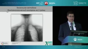 Дивертикул Ценкера