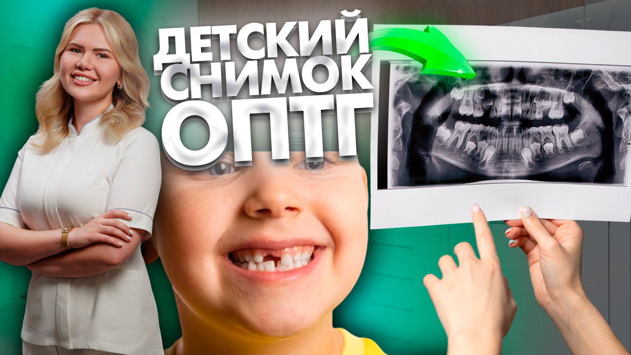 Что видит врач детский стоматолог ортодонт на снимке ОПТГ? Детская стоматология.