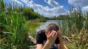 14 день после пересадки волос (ФИНАЛ)  [отчёт]