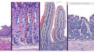 GIT pathology 1 (basic)