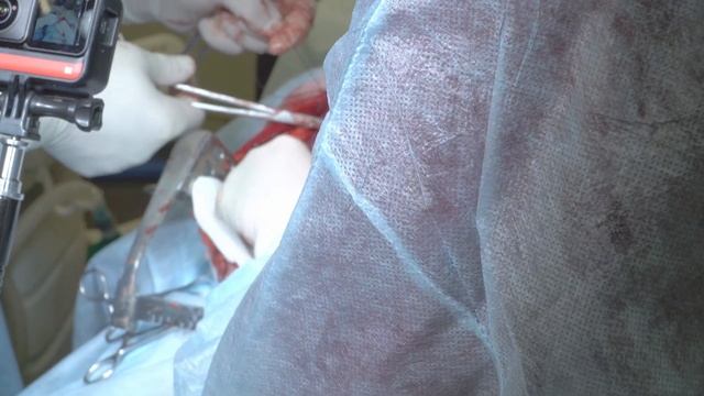 Диафрагмальная грыжа у собаки. Что произошло с печенью. Селезенка и печень в перикарде. смотреть онлайн