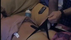 Кинезиолгическое тейпирование при переломе крестца