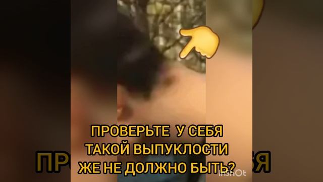 Если на фото пятна не кажутся,то уже чeл0BeKy cp0чH0 надо было в б0лbHuцy, но веселье продолжалось смотреть онлайн