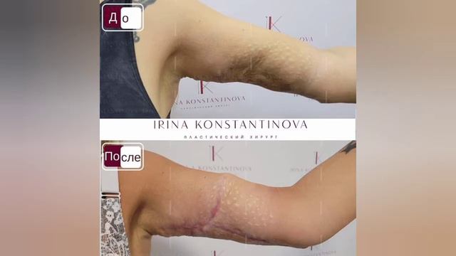 История Екатерины - героини передачи "Мужское Женское" на Первом канале смотреть онлайн