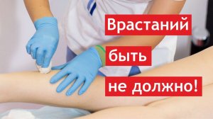 У ваших клиентов врастают волосы после депиляции? Научим, как этого избежать