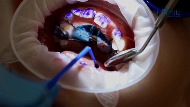 МосСмайл. Детская стоматология. Гигиена смотреть онлайн