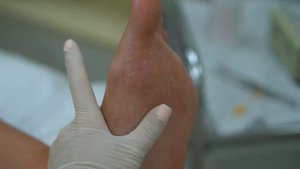 SMART-педикюр