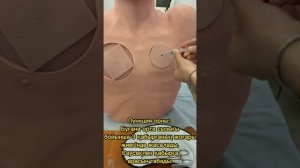 Пневмоторакс кезіндегі Плевральды пункция жасау техникасы. Плевральная пункция  при пневмотораксе.
