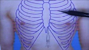 Пункция плевры пункция перикарда