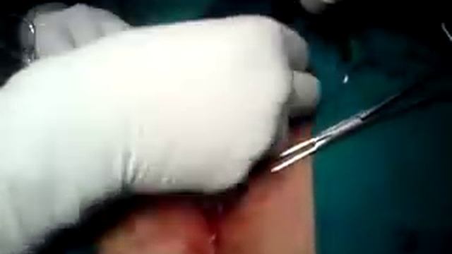 копчиковый ход 1 смотреть онлайн