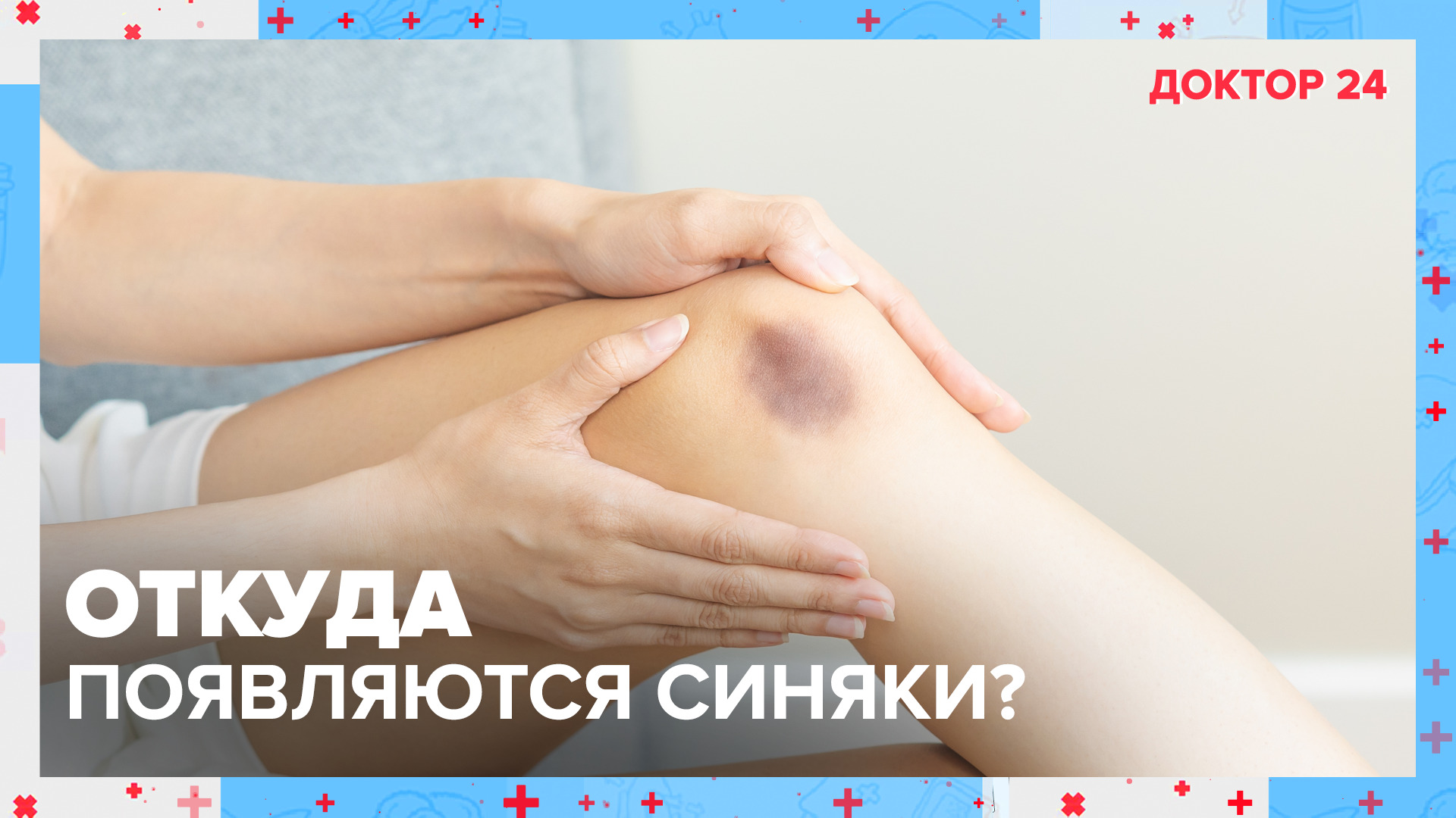 Откуда появляются СИНЯКИ? | Доктор 24