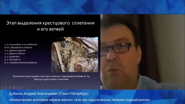Доклад «Клиническая анатомия нервов малого таза при хирургическом лечении эндометриоза»
