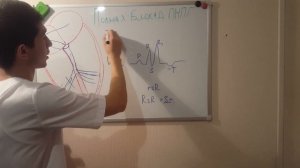 ПОЛНАЯ И НЕПОЛНАЯ БЛОКАДА ПРАВОЙ НОЖКИ ПУЧКА ГИСА!