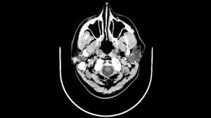 Tatu - Memento Mori - Feat. EsmoStuff