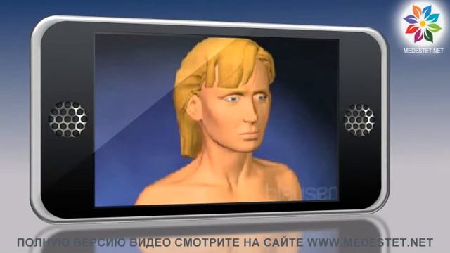 Пластика бровей (подтяжка бровей)