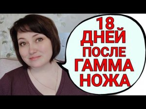 Какие осложнения после гамма-ножа? Облучённые метастазы в мозжечке меня "укачивают".