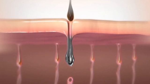 დიოდური ეპილაცია (მიმოხილვა) "რაფაელი" смотреть онлайн