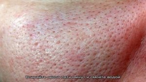Как почистить лицо в домашних условиях?