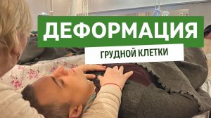 Воронкообразная деформация грудной клетки