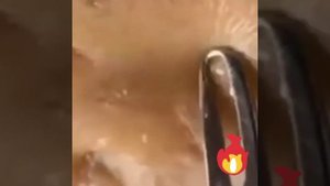 Давим жирные угри. Релаксация для глаз.