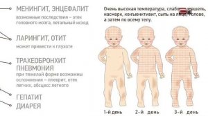 Медики рассказали, кому из взрослых и когда необходимо прививаться от кори