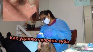Как удаляют корень зуба