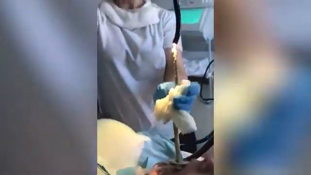 Змея заползла девушке в рот