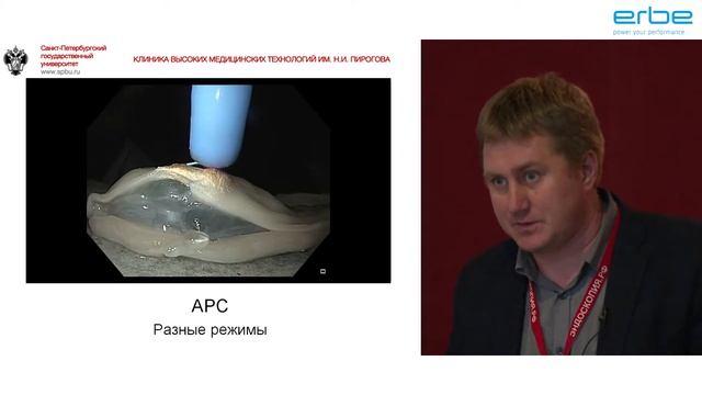 Аргоноплазменная коагуляция в эндоскопии ERBE. Мальков В.А. смотреть онлайн