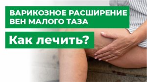 Варикоз малого таза. Синдром хронической тазовой боли.