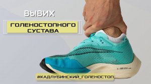 Вывих голеностопного сустава